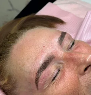 Brow treatment